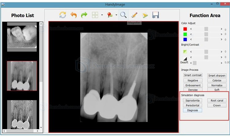 Handy HDR 500 sensores intraorales rayos x radiologia digital dental USB